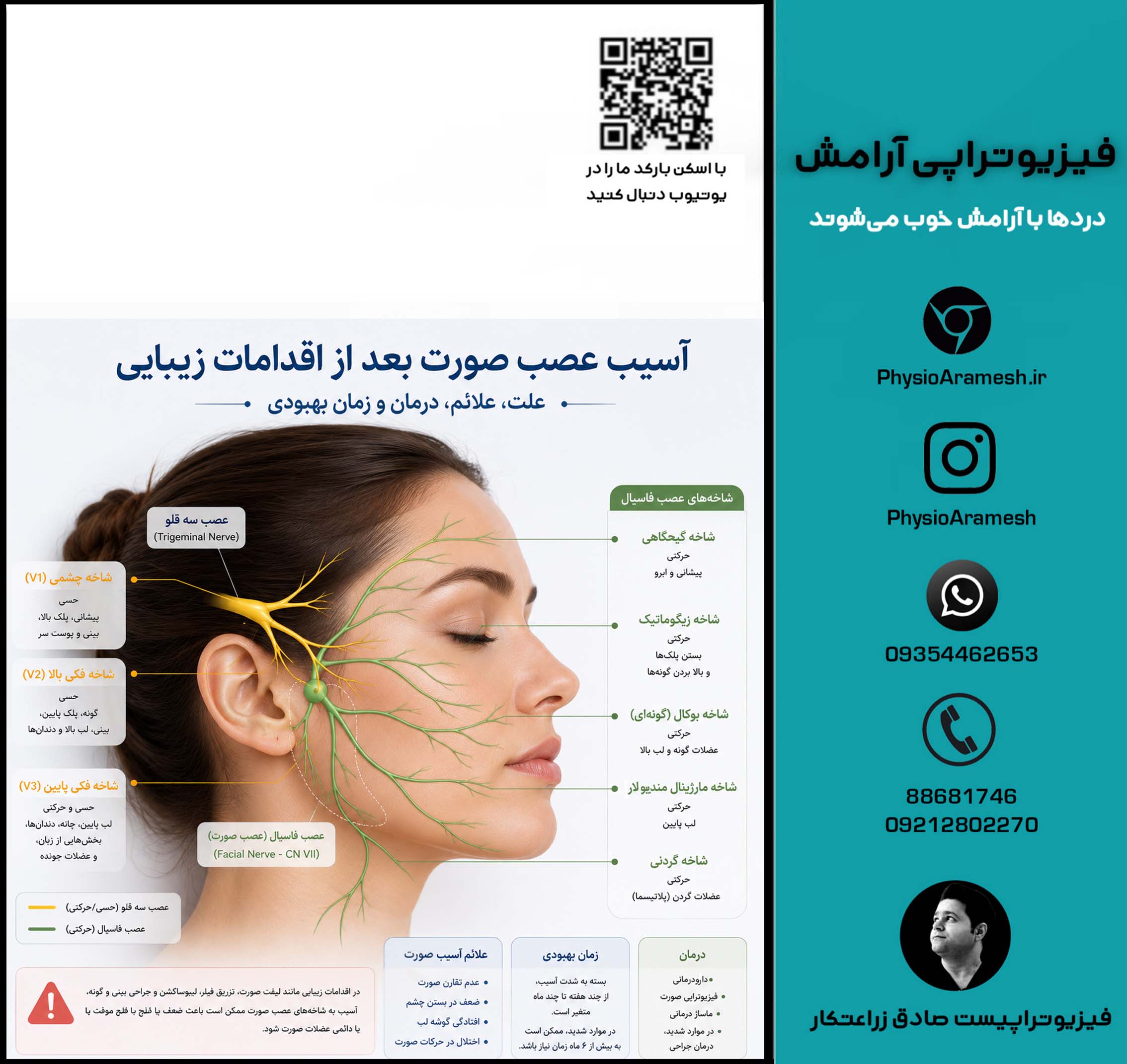 آسیب عصب صورت بعد از اقدامات زیبایی